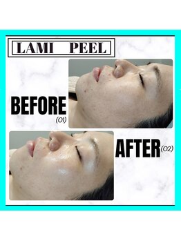 グランディールアン(GRANDIR UN)/LAMI PEEL