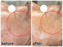 アンジェーム(angeame)/一度で、この効果！