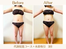 ヨサパーク ククナ 大塚(YOSA PARK kukuna)/痩身/ダイエット/よもぎ蒸し痩身