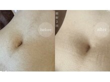 アンドエピ(&epi)/