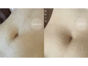 アンドエピ(&epi)/