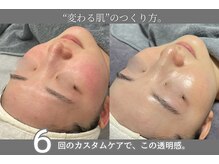 カスタムケアで肌が変わる実感をあなたにも。お客様満足度◎