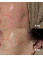 アンドミー(and me)/鹿児島/唐湊/トータルケア