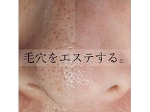 ニューリー(Newly.)の雰囲気（毛穴悩みも卒業◎みっちり詰まった角栓もお任せください♪）