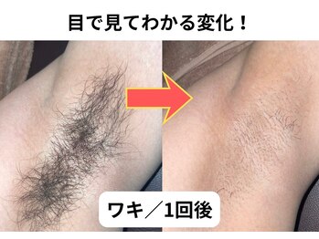 NTエステティック 西条店/