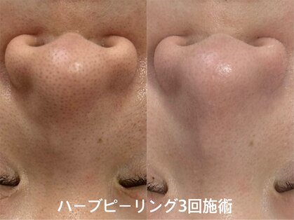 エードット スパ アンド ハーブ(a.spa & herb)の写真