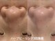 エードット スパ アンド ハーブ(a.spa & herb)の写真