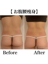 モット 神戸店(Motto)/お尻痩身