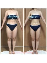 ラヴィソンファム(Ravissant femme)/痩身エステ/ビフォー&アフター