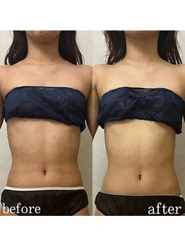 サロンドリシェス(Salon de RICHESSE)/痩身メニュー