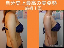 ボディエイジングラボ マハロ(MAHALO)/お急ぎブライダル1day