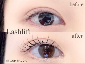 アイランド トーキョー(ISLAND TOKYO)/まつげパーマ(ラッシュリフト)