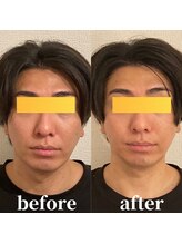 ロータス ビューティー(LOTUS Beauty)/小顔/むくみ解消/首肩