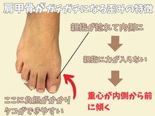 ニコ(niko)/親指の付け根のタコは注意