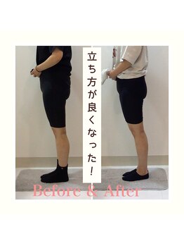 スタイルラボ高松/産後の骨盤矯正の効果♪