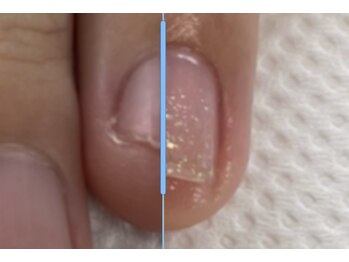 左.初回来店-右.三ヶ月後の変化