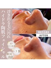 リコ 白金台(Liko)/