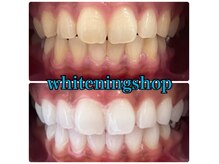 ホワイトニングショップ 西尾店の雰囲気(生まれ持った本来の白さを手に入れよう!ホワイトニング/西尾)