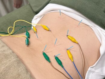 しゅんぷう/【鍼灸/鍼】