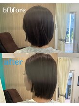 西宮ヤノ整骨院/20代女性　肩の凝り、首の痛み