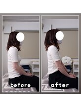 ぷめはな整体/before/After