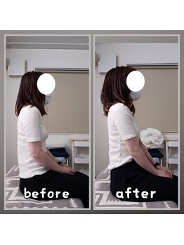 ぷめはな整体/before/After