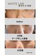サロン リノ(salon rino)の写真/結果重視◎格上のシミ改善体験!7日後の変化。60日後の確かな結果へ。隠す肌から自信の持てる素肌へ!