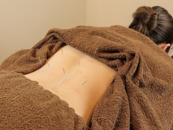 キズシンキュウ(KIZU SHINKYU)の写真/【鍼灸でお悩みを根本改善したい方へ◎】身体の痛み緩和、改善に導きます！まずはお気軽にお越しください。