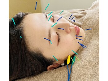 熊本鍼灸小雀斎/美容はり＋微弱電流で小顔に！