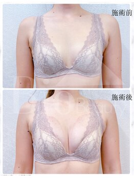 シアンビビ(Cyaan bibi)/最新バストケア