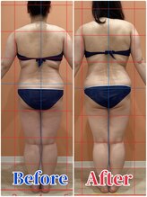 ハンズ鍼灸接骨院小牧院 美容整体ハンズ(美容整体hands)/ハイパーナイフ 痩身