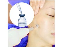 アンジェリナ 東山公園駅前店(angelina)の雰囲気(針を使わないリジュラン注射、幹細胞培養液で湧き上がるツヤを。)