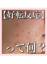 アルムダアクア 天王寺店(Aleumda AQUA)/ハーブピーリング/大阪/天王寺