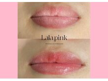 ハーシークレット(Her secret)/ララピンク・メラニンケア