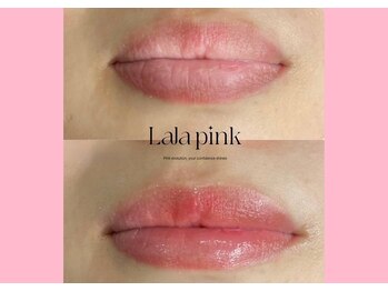 ハーシークレット(Her secret)/ララピンク・メラニンケア