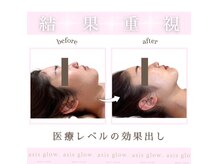 エイシスグロウ(asis glow.)の雰囲気（脂肪燃焼液導入×ハイサーマでこの効果！満足度抜群★）