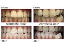 ホワイトニングショップ 西原店の雰囲気(おタバコを吸われる方もホワイトニング◎ヤニ汚れも綺麗に★*)