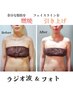 【美人度UP♪美肌＋上半身ケア】フォト半顔＋ラジオ波2ヶ所＋筋膜リンパ