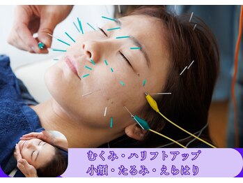 フラット柏(FLAT柏)/美容鍼×小顔マッサージ