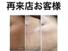 リピ率NO.1【透明美肌】さよならストレス☆しわ・くすみ改善潤ツヤUP15000→