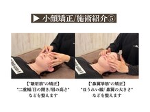 カラダコンシェルジュN(KARADAコンシェルジュN)/【小顔矯正】施術シーン紹介５
