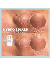 フルアナ(Hu ruana)/フェイシャルエステ