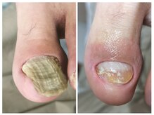 フレッシュフット(FreshFoot)/足のトラブルお任せください