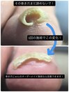 完全オーダーメイド施術とは？