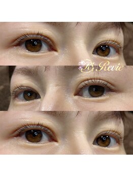 レビー(Revie)/セラムラッシュリフト