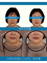 ハリラボ(hari Lab.)/【お客様の声】