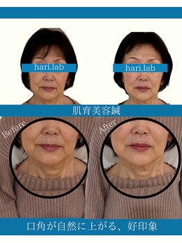 ハリラボ(hari Lab.)/【お客様の声】