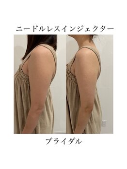 サラ/ニードルレスインジェクター