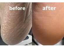 ビケア(vicare)の雰囲気(見えない所まで綺麗に。ガサガサかかとの改善ケア。)