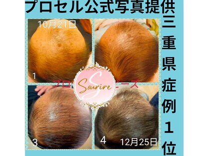 スリール(sourire)の写真